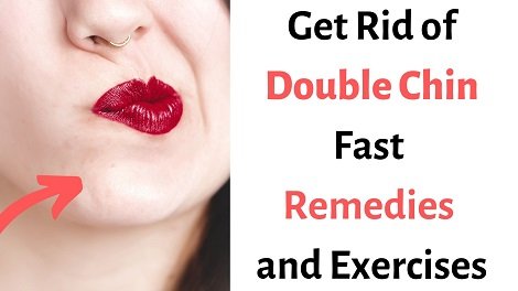 Read more about the article How to Get Rid of Double Chin – Exercises and Remedies